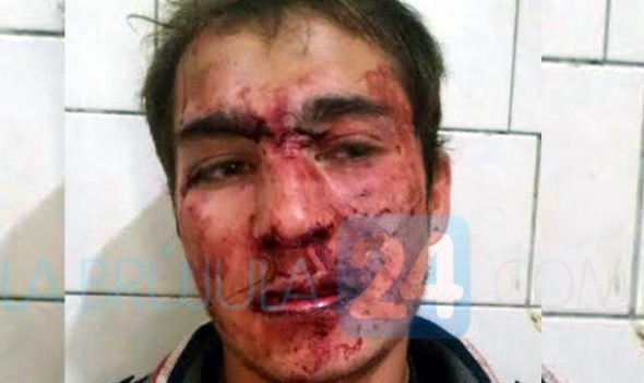 Cansados de los robos, empleados de una estación de servicio desfiguraron a un delincuente